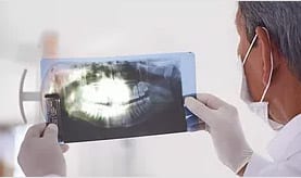 Photo of Dentist looking at teeth X-Rays